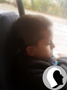 CI Kopf 2018 männlich Kind